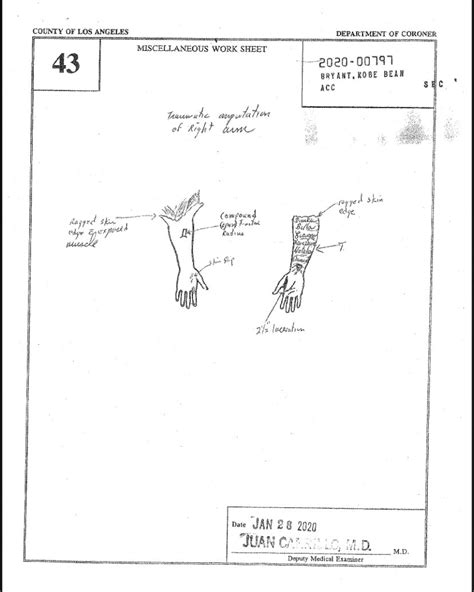 kobe autopsy gigi|LA County Coroner releases autopsy reports for。